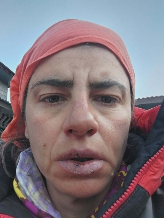 ν3